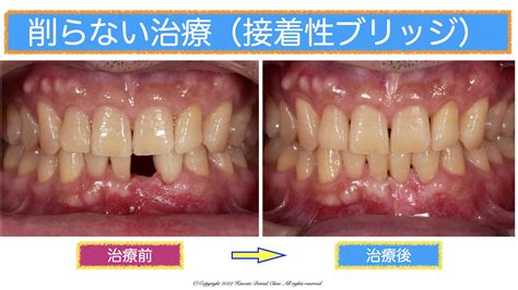 ブリッジフェラ|ブリッジでフェラ！アクロバチックにチンコ舐めてるエロ画像